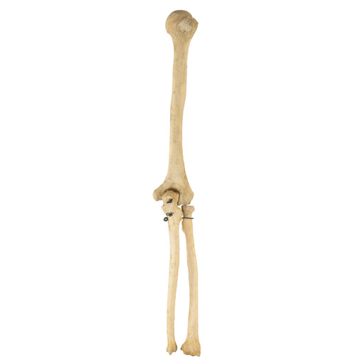 Real Human Humerus, Radius, and Ulna