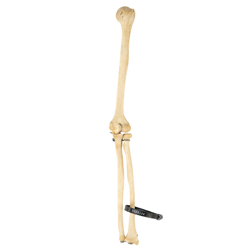 Real Human Humerus, Radius, and Ulna