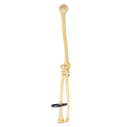 Real Human Humerus, Radius, and Ulna