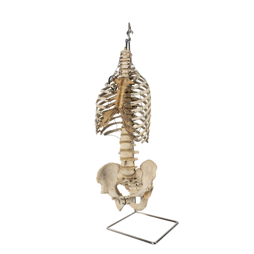 Real Human Torso and Pelvis on Stand