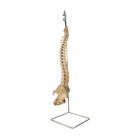 Real Human Spine and Pelvis on Stand