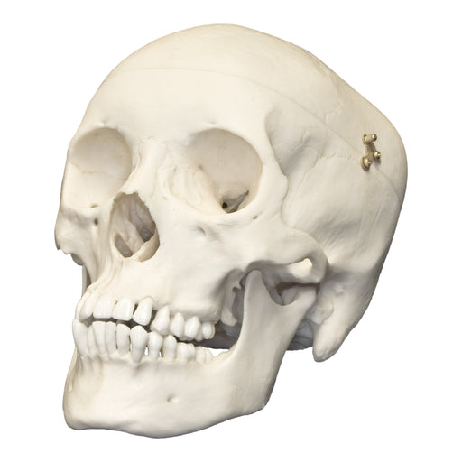 Replica Human Male Adolescent Skull with Calvarium Cut