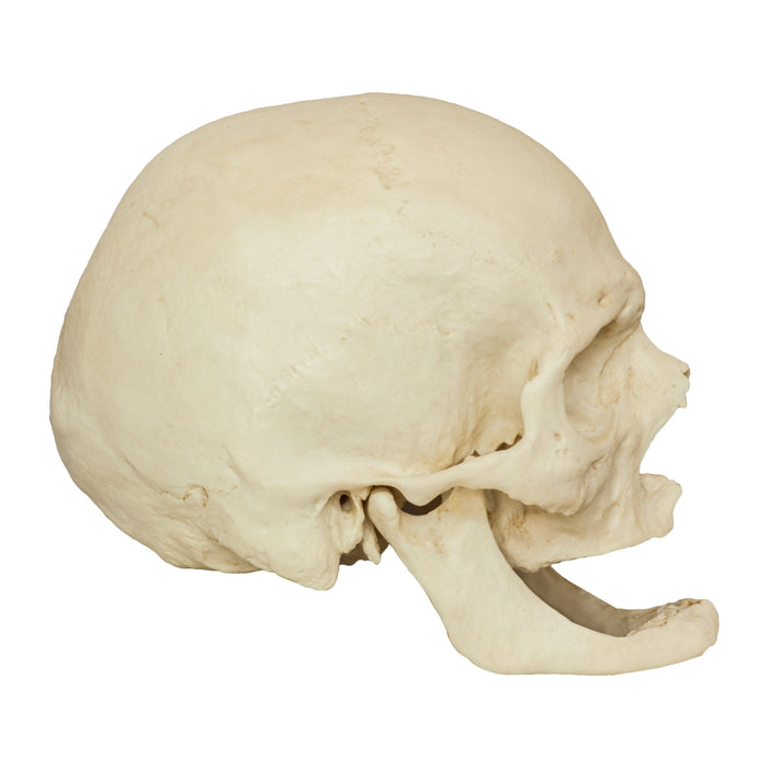 Human Male European Skull - Bone Clones, Inc. - Osteological Reproductions