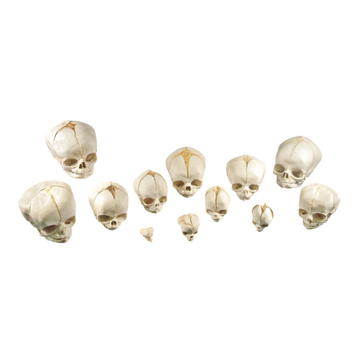 Replica Human Fetal Skulls - Set of 12