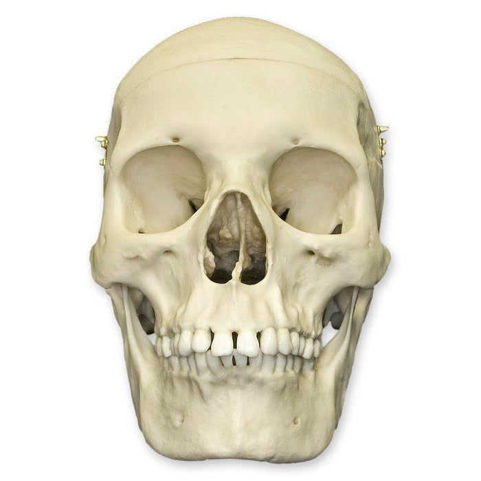 Replica Human Female Medical Quality Skull with Calvarium Cut