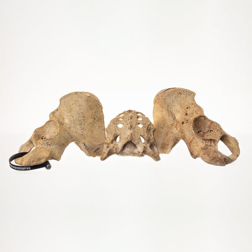 Real Human Pelvis and Sacrum - Antique