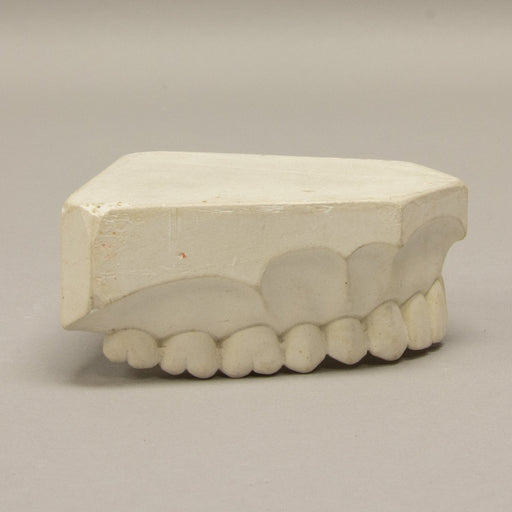 Replica Orthodontic Study Model