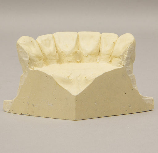 Replica Orthodontic Study Model