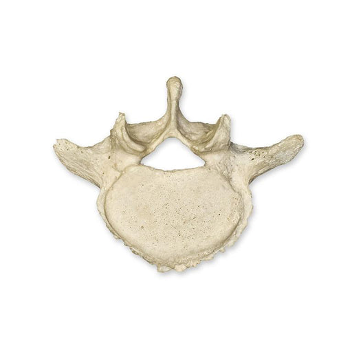 Real Human Lumbar Vertebra - Single