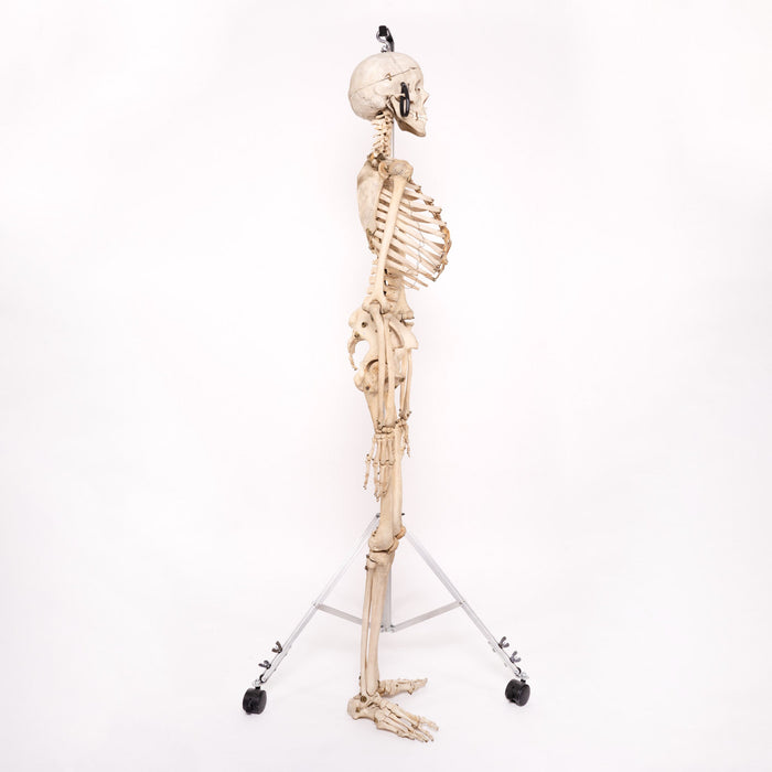 Real Human Skeleton - Articulated Antique — Skulls Unlimited International,  Inc.