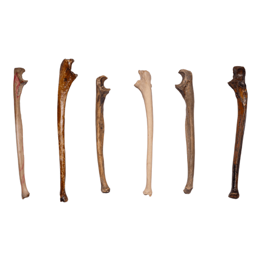 Real Human Ulna - Antique