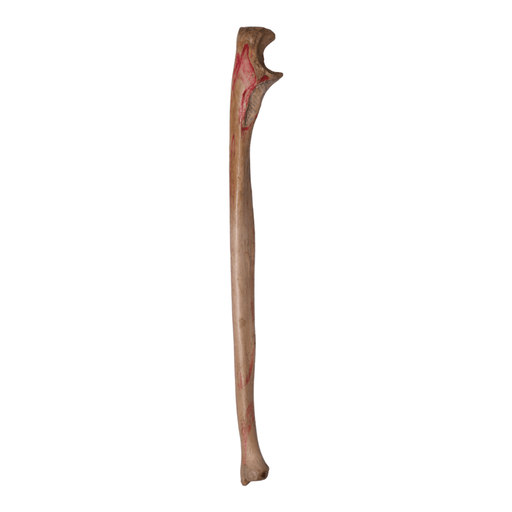 Real Human Ulna - Antique