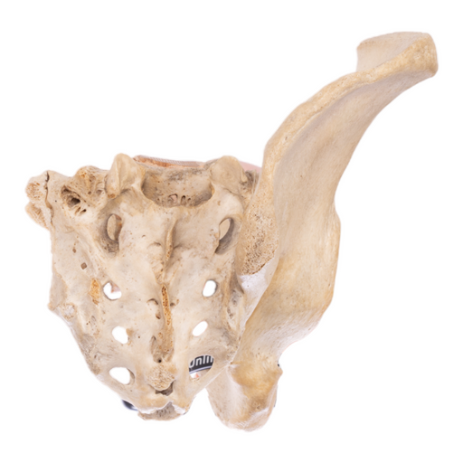 Real Human Pelvis - Partial, Antique